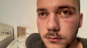 Повређени-Стефан-Томић-1-фотографија-ККиМ-e1673084312750-1000x560