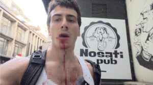 1749368079-Neven-Krstic-napadnut-u-cacilendu