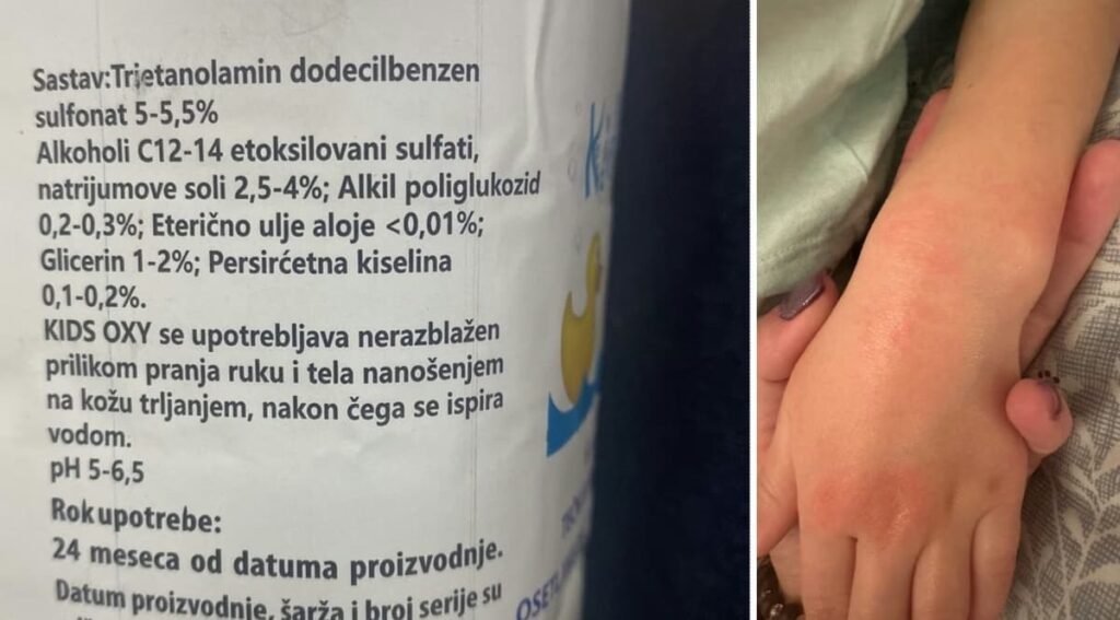 1774524611-1774522899-дете-рука-.формат-авиф.wидтх-1200